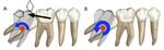 1329 Fig.2
