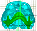 1130 Fig.11