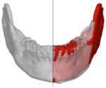 1130 Fig.12